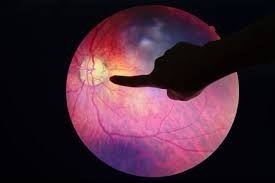 Diabetic retinopathy treatments
