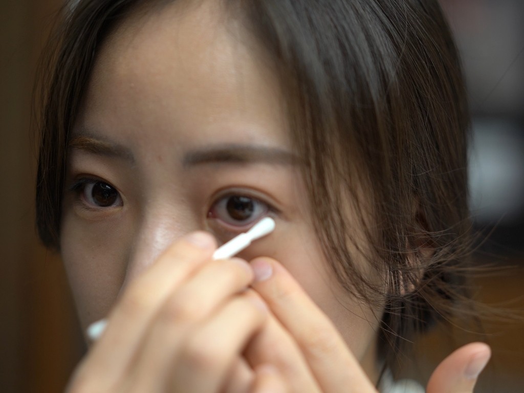The relationship between dry eye and blepharitis