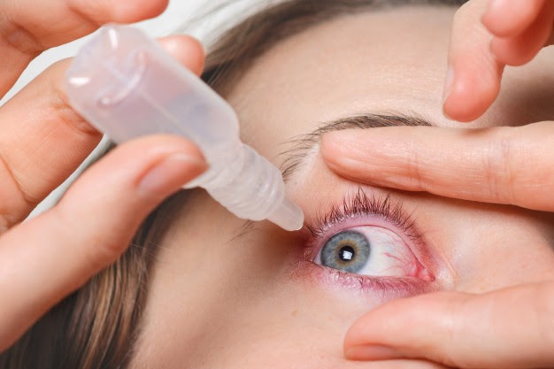 LASIK Surgery | Tips after LASIK surgery